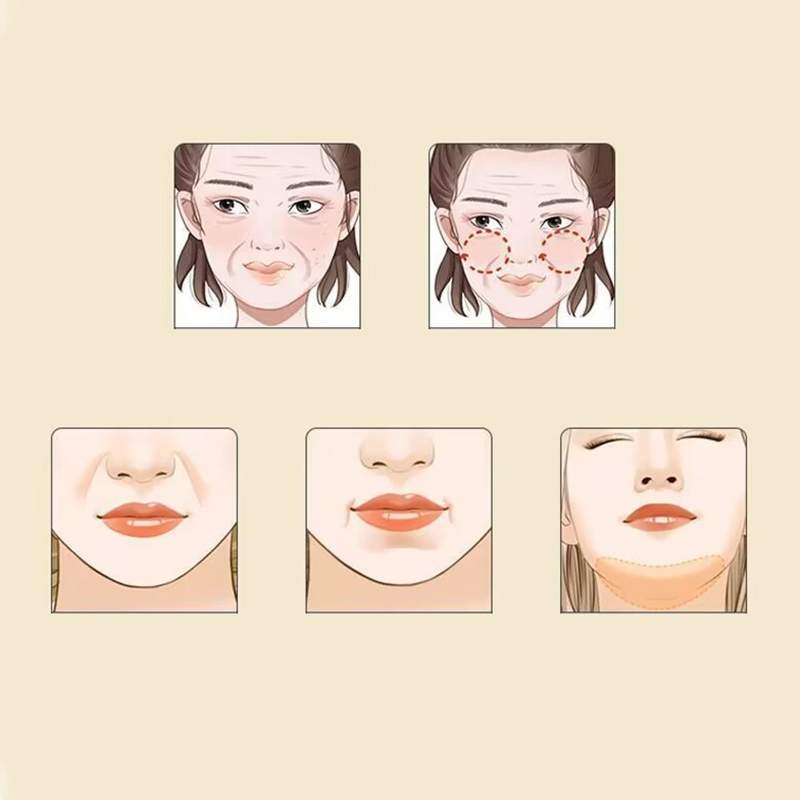 V-Line Face Slimming Mask & Double Chin Reducer Strap - Image 4
